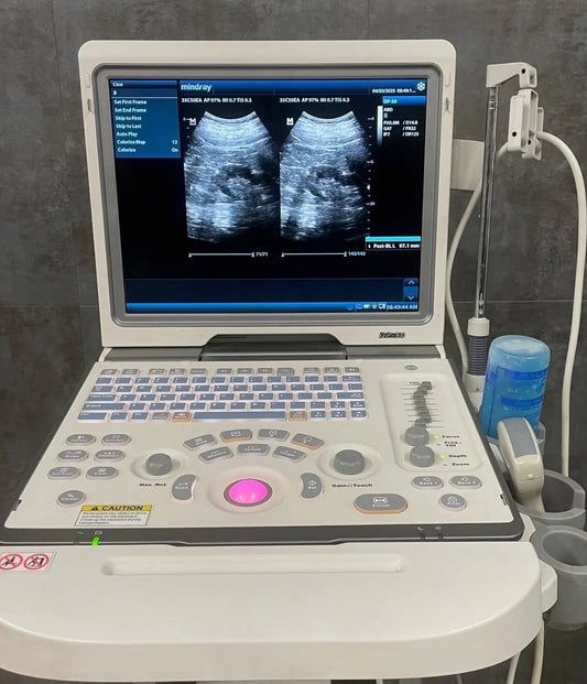 Mindray DP-50 Ultrasound “used” Buu
